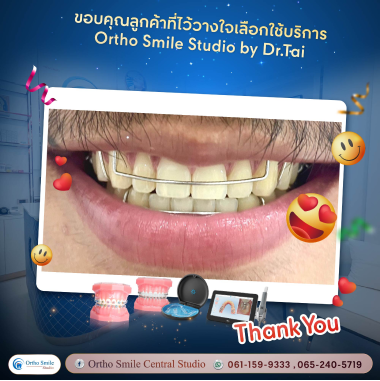 review1
